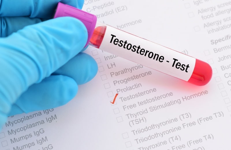 blood sample with requisition form for testosterone hormone test