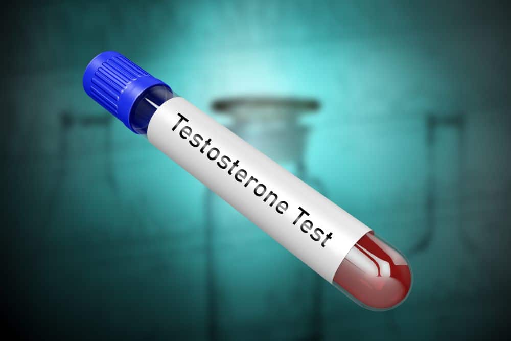 Blood sample in the tube for testing testosterone levels.